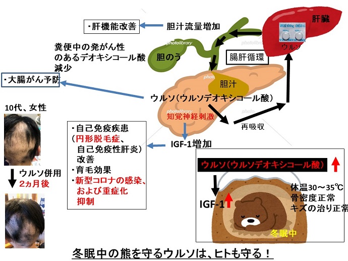 円形脱毛症　病院